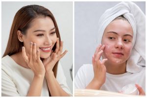 Skincare bisa menghilangkan bopeng di wajah? Begini penjelasan medis dan rekomendasi perawatannya