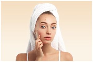 [KUIS] Hati-hati jerawatan, cari tahu kebiasaan yang tak boleh dilakukan saat skincare-an di sini!