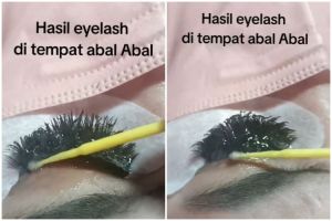 Cewek ini pasang eyelash extension biar cantik malah berujung sial, begini kisah nyeseknya