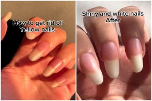 Campuran garam dan 1 bahan dapur ini bisa bikin kuku kuning jadi putih berkilau, ini cara meraciknya
