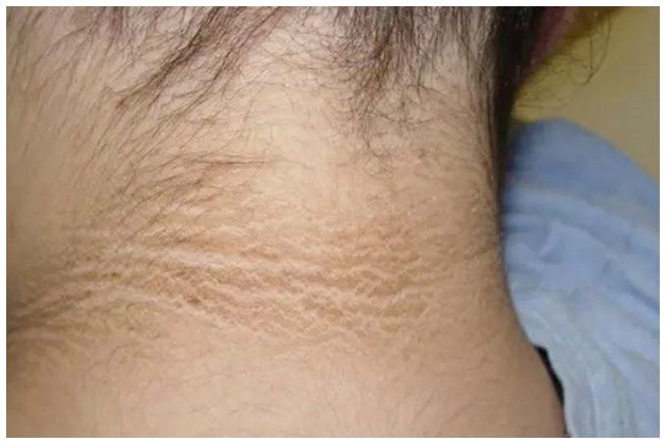 [KUIS] Belakang leher tampak hitam? Cari tahu trik sederhana hilangkannya lewat pertanyaan ini