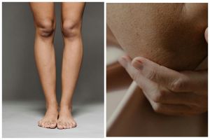 [KUIS] Kebiasaan buruk ini ternyata bisa bikin siku dan lutut gelap, cari tahu lewat pertanyaan ini