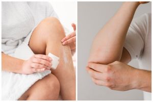 [KUIS] Punya siku atau lutut yang hitam? Yuk cari tahu bahan alami apa untuk bantu cerahkan