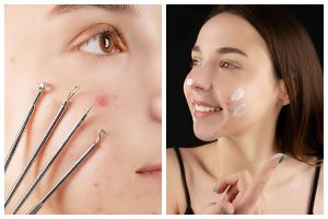 9 Produk skincare penghilang milia di apotik harga di bawah Rp 200 ribu, wajah auto mulus