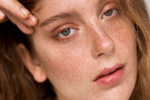 Campuran susu dan 2 bahan dapur ini bisa atasi flek hitam di wajah, cara membuatnya cuma 5 menit