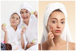 9 Kandungan skincare untuk kulit berjerawat aman untuk remaja, nggak bikin iritasi