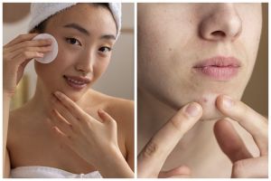 8 Rekomendasi skincare MS Glow untuk kulit berminyak dan berjerawat harga di bawah Rp150 ribu