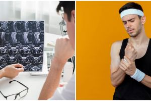 8 Gejala neuropati ini perlu diwaspadai, kenali gejala dan cara mengatasinya