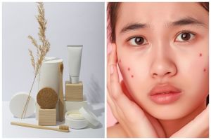 Jangan sampai tertipu, ini 7 ciri-ciri skincare merkuri dan bahayanya yang perlu diketahui