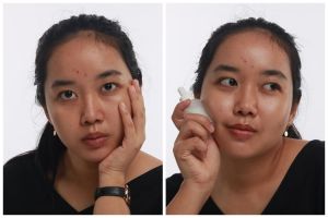 Bantu hilangkan bekas luka, kenali apa itu skincare microneedling, manfaat, dan cara menggunakannya