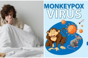WHO tetapkan status darurat kesehatan global, ini 9 cara jaga tubuh agar terhindar dari cacar monyet