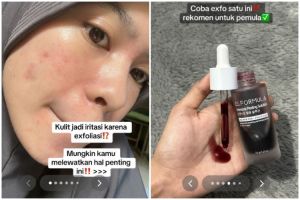 Jangan asal, cewek ini bagikan cara eksfoliasi wajah yang tepat agar kulit antiiritasi
