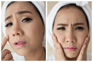 7 Cara mengatasi wajah perih saat memakai skincare ini bikin kulit calm down