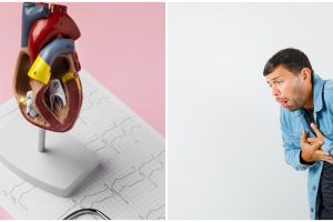 Bisa sebabkan stroke, ini 6 cara deteksi dini atrial fibrilasi, penyebab, dan cara mengobatinya