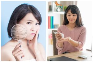 [KUIS] Kamu punya kulit yang kering? Cari tahu 8 cara pencegahan yang bisa dilakukan di rumah