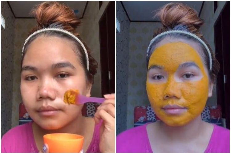 Momen kocak cewek usai pakai masker penghilang bekas jerawat ini bikin kasihan tapi pengen ketawa