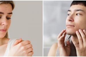 7 Cara menghilangkan bekas luka jahitan, pahami perawatannya agar tak salah kaprah