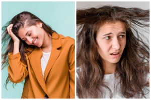 9 Cara menumbuhkan rambut dengan cepat dalam 3 hari pakai bahan alami ini bikin lebat kembali