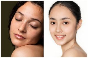 9 Rekomendasi skincare untuk mengatasi jerawat pasir, bikin kulit halus bebas beruntus