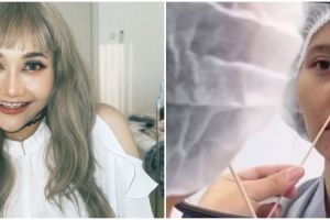 Riyuka Bunga pamer hidung baru hasil operasi plastik, penampilannya jadi mirip Prilly Latuconsina