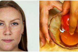 Tanpa serum niacinamide, ini cara atasi flek hitam di wajah agar cerah merata pakai 2 bahan dapur