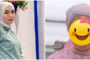 Imel Putri pamer potret usai perawatan wajah di usia 35 tahun, netizen sebut mukanya jadi tampak tua