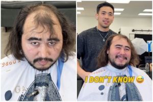 Bak beda orang, transformasi pria rambut botak usai di-styling ini penampilannya bikin melongo