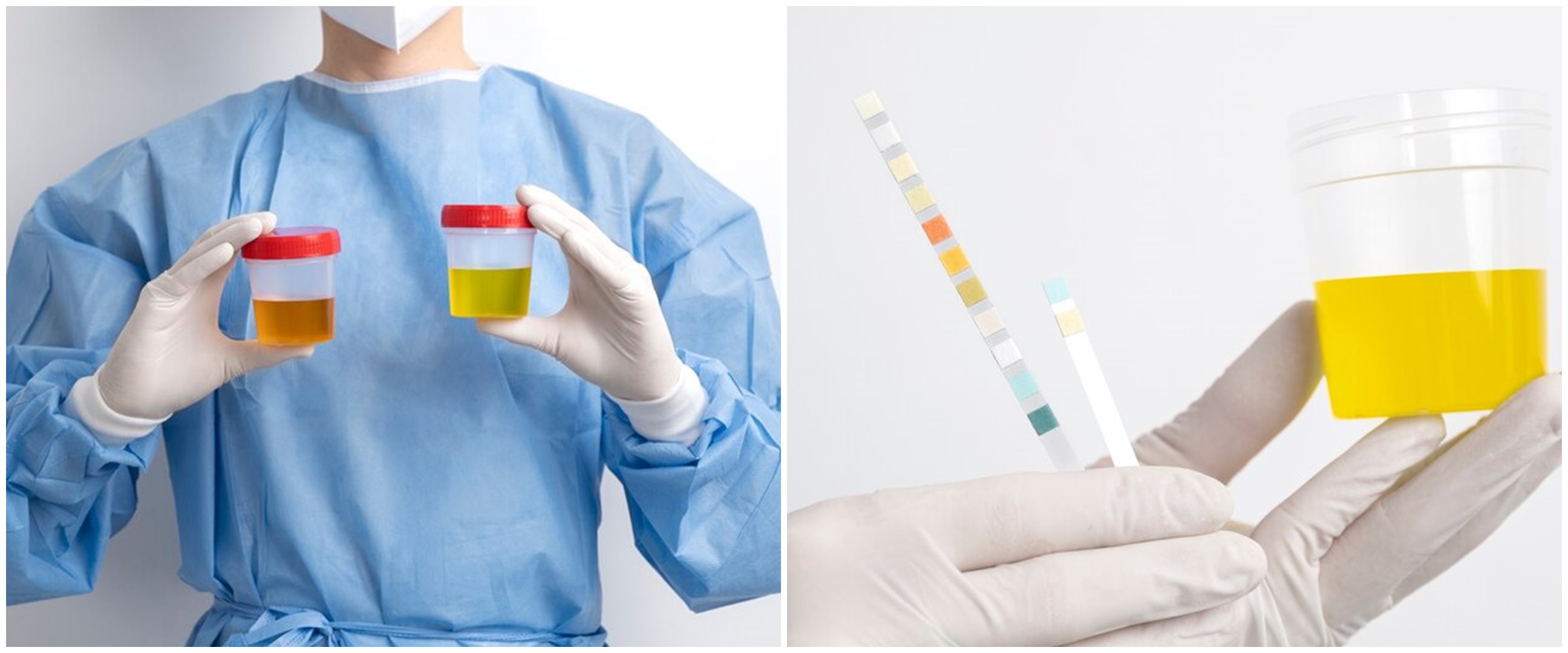 Macam macam warna urine dan artinya, disertai tips mengatasinya