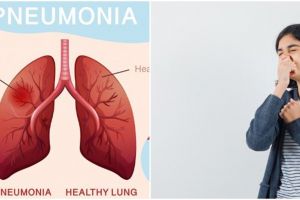 Bukan karena mandi malam, ini 8 kebiasaan sepele yang jadi penyebab paru-paru basah