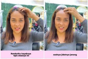 Transformasi cewek rambut botak depan & jenong usai di-styling ini bak beda orang, langsung auto muda