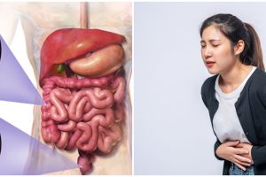 Kenali 7 pemicu kanker usus besar di usia muda, lengkap dengan cara mencegahnya