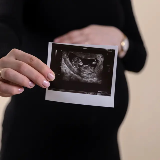 5 Tafsir mimpi melihat orang hamil kembar, simbol peluang baru