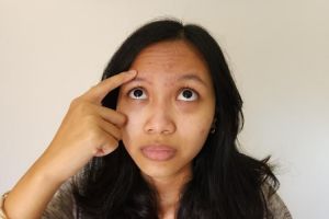 Kombinasi madu dan bahan dapur ini bisa atasi beruntusan di dahi, begini cara meraciknya