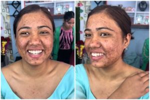 Transformasi cewek dengan wajah penuh bekas jerawat dirias soft glam, hasilnya auto mulus bebas noda