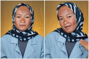 Transformasi wanita wajah penuh flek hitam dirias pengantin hasilnya bak beda orang, jadi auto muda