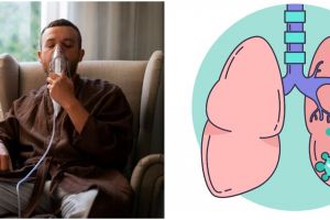 Jangan diabaikan, kenali gejala awal paru-paru basah dan cara mengobatinya