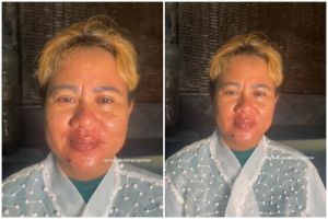 Transformasi wanita kulit berpori besar dirias jadi pengantin hasilnya bak beda wajah, mulus pol