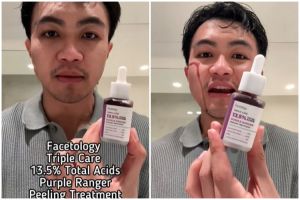 Review Facetology Purple Ranger Peeling diklaim aman untuk usia 16 tahun, bikin cekat cekit nggak?