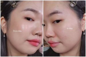 Jangan langsung diusap, trik pakai micellar water di wajah sensitif ini bikin kulit minim iritasi