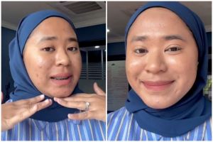 Bukan pakai color corrector, trik tutupi jaringan parut jerawat ini justru pakai produk tak terduga