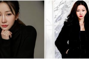 Lucinta Luna akui ketagihan operasi plastik meski taruhannya nyawa, ternyata ini alasannya