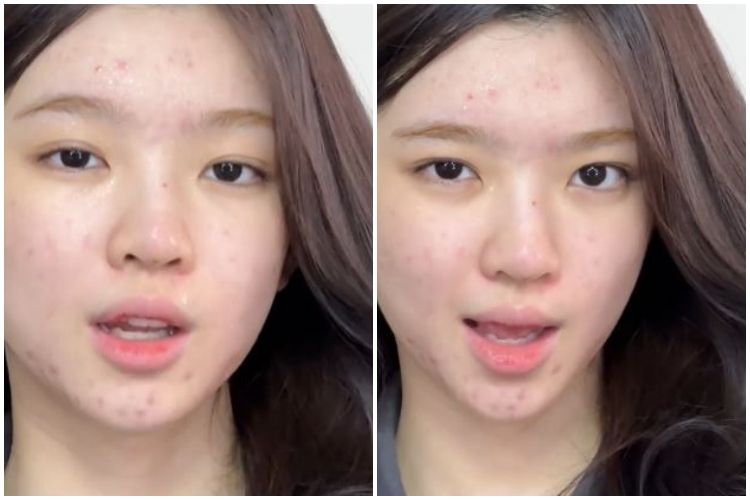 Transformasi cewek dengan dark spot di wajah dirias ala clear makeup ini hasilnya mirip Tiara Andini