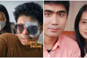 Kini tak lagi bisa berobat pakai BPJS, Agus korban penyiraman air keras kembali minta donasi ke Novi