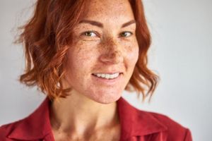 Campuran teh hitam dan 2 bahan dapur ini bisa atasi flek hitam di wajah, begini cara mudah membuatnya