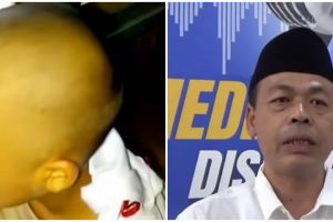 Anak tak mau sekolah usai digunduli paksa, ayah ini sakit hati dengan perlakuan sang guru