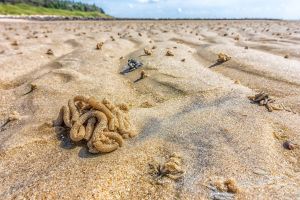 Tiga pola hidup sehat untuk menjaga kesehatan sistem ekskresi