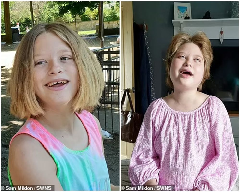 Bocah 12 tahun ini alami kebutaan permanen usai konsumsi burger dan donat, dokter jelaskan penyebabnya