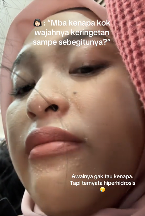 Kerap keringetan walau di ruang ber-AC, kenali apa itu hiperhidrosis, gejala, dan penyebabnya