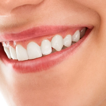 Trik memutihkan gigi kuning dan berkerak pakai 1 jenis buah tanpa campuran garam