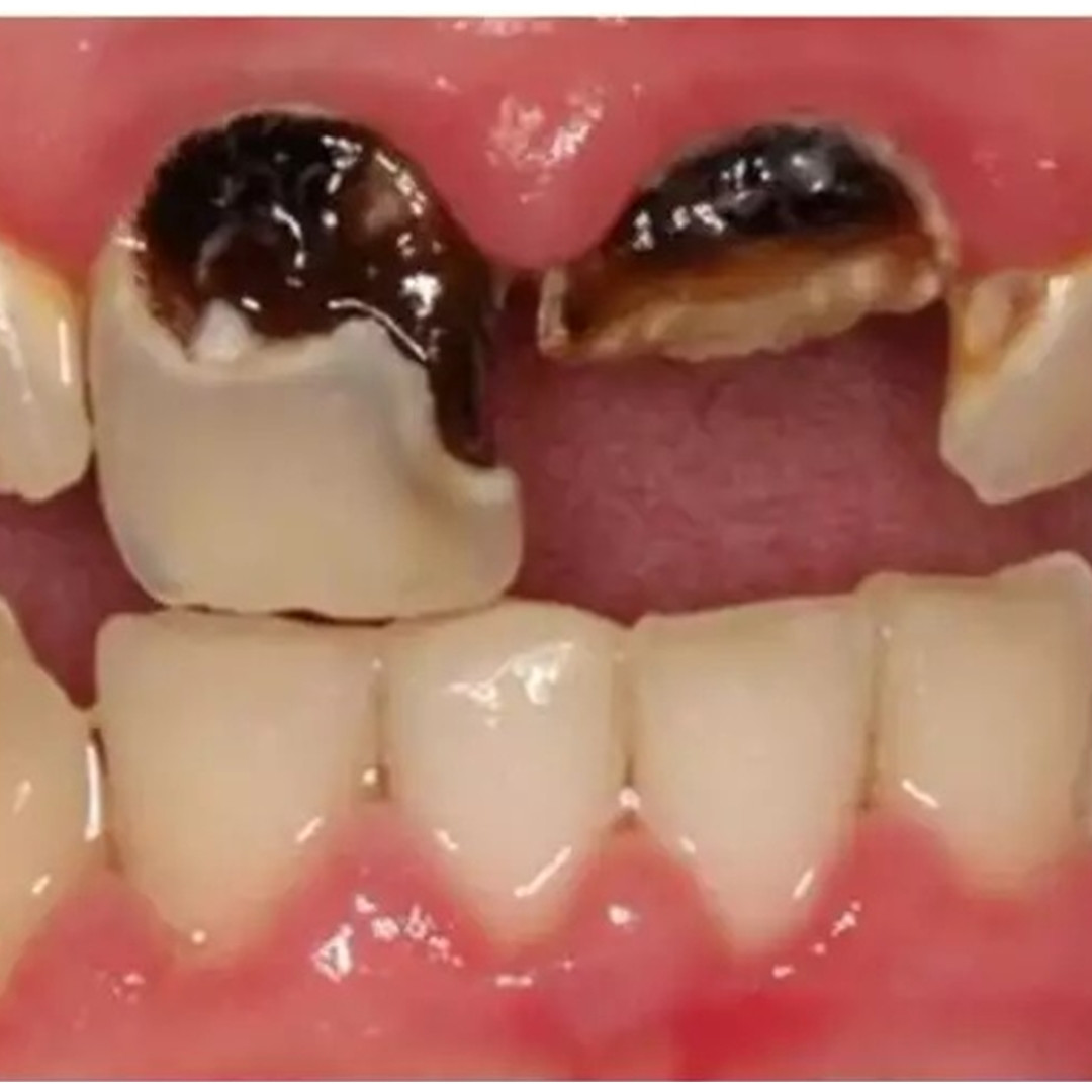 Cara ampuh rontokkan plak hitam menempel di gigi agar auto bersih, cuma pakai 1 jenis rempah